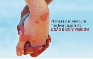 Dia Mundial da Psoríase: dermatologista Cintia Otsubo explica sobre a doença